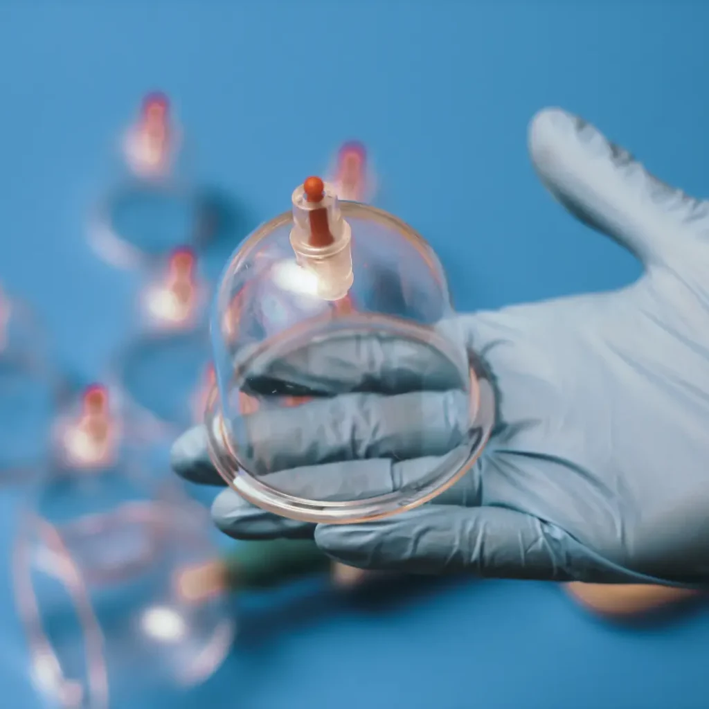 Cupping (Hijama) Therapy in Pune