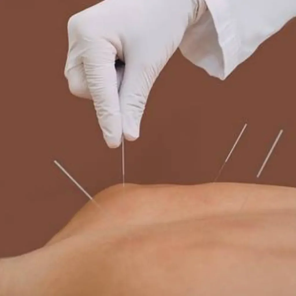 best acupuncture services in pune