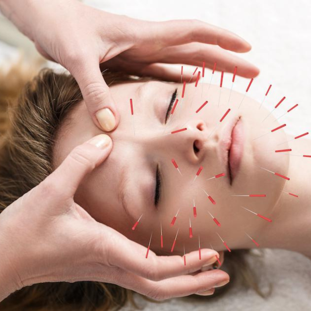 cosmetic acupuncture services in pune